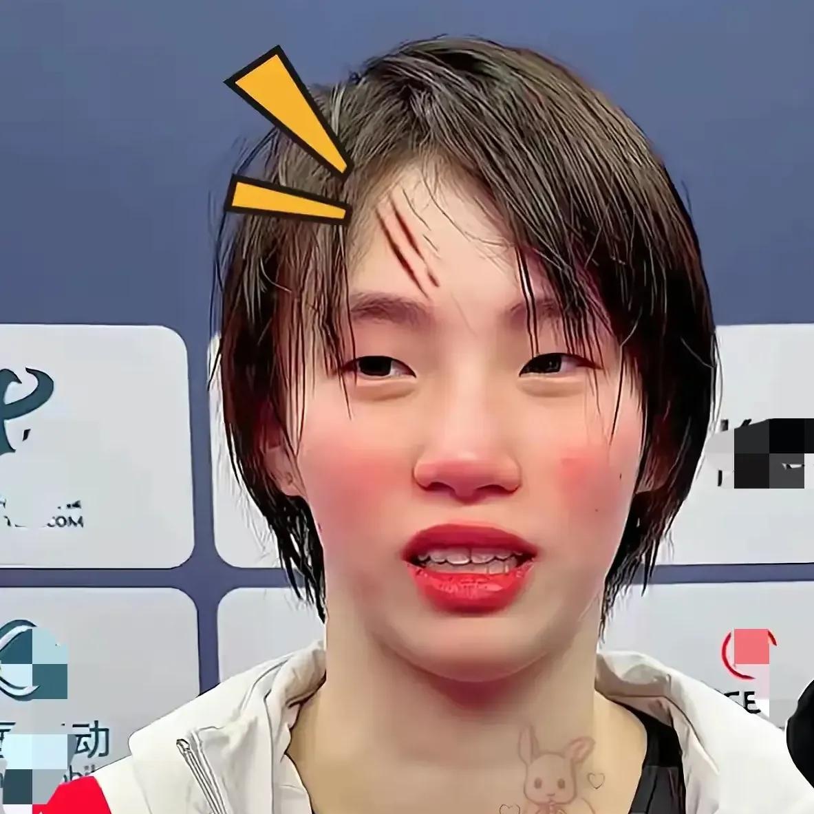 赔率变化明星选手受伤退赛，引发热议